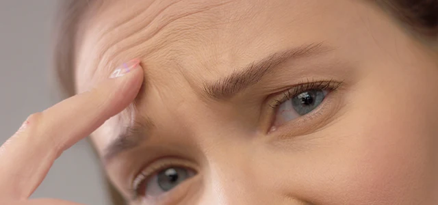 Botox gegen Stirnfalten